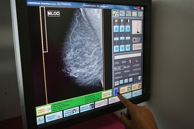 Casi 4.700 extremeñas se someterán a mamografías en diciembre dentro del Programa de Detección Precoz del Cáncer de Mama