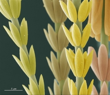 Técnicos de la UEx consiguen un premio de fotografía científica con la imagen de una levadura utilizada en la cerveza