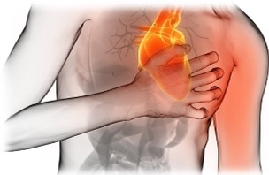 ¿Qué síntomas aparecen ante un infarto de miocardio?