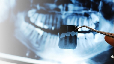 Más de la mitad de los niños extremeños no utilizan el programa gratuito de Atención Dental Infantil