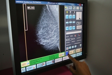 Casi 8.500 extremeñas se someterán a mamografías en marzo dentro del Programa de Detección Precoz del Cáncer de Mama