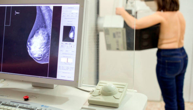 Más de 7.700 extremeñas se realizarán mamografías en septiembre dentro del Programa de Detección Precoz del Cáncer de Mama