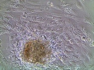 Investigadores de la Universida extremeña demuestran que la melatonina mejora las células sanas del páncreas