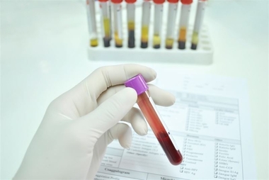 Los equipos del Banco de Sangre de Extremadura recorrerán casi 11.000 kilómetros en octubre para realizar 63 colectas